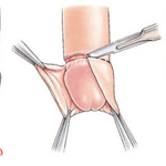 đâu là địa chỉ cắt bao quy đầu ở hà đông uy tín?