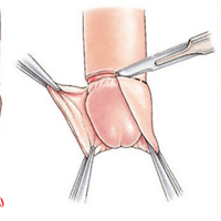 Đâu là địa chỉ cắt bao quy đầu ở Hà Đông uy tín?